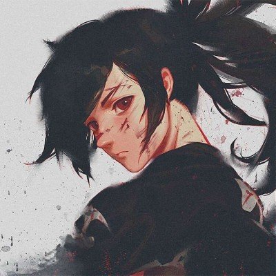 女孩吃流产药后长期卧床腰臀长疮